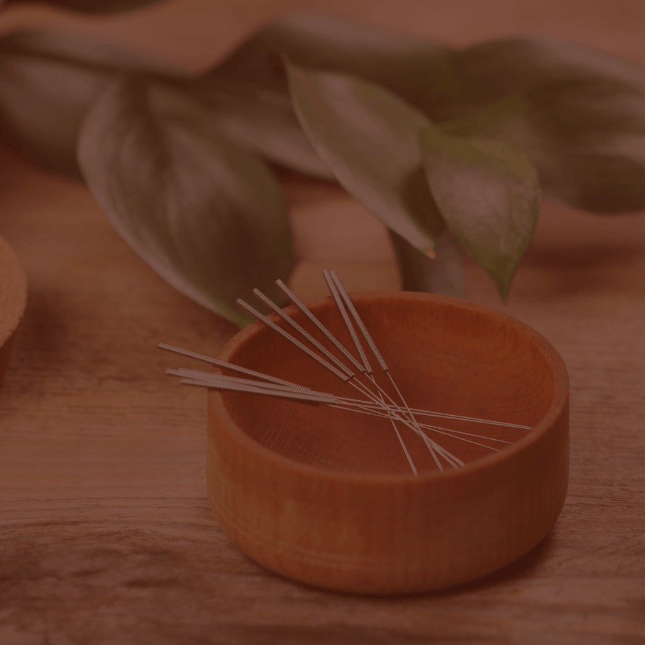 Interview with The Cheshire Acupuncturist about fertility and women's health