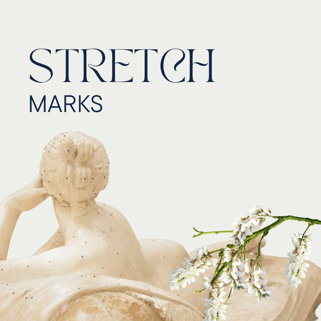 Stretch marks